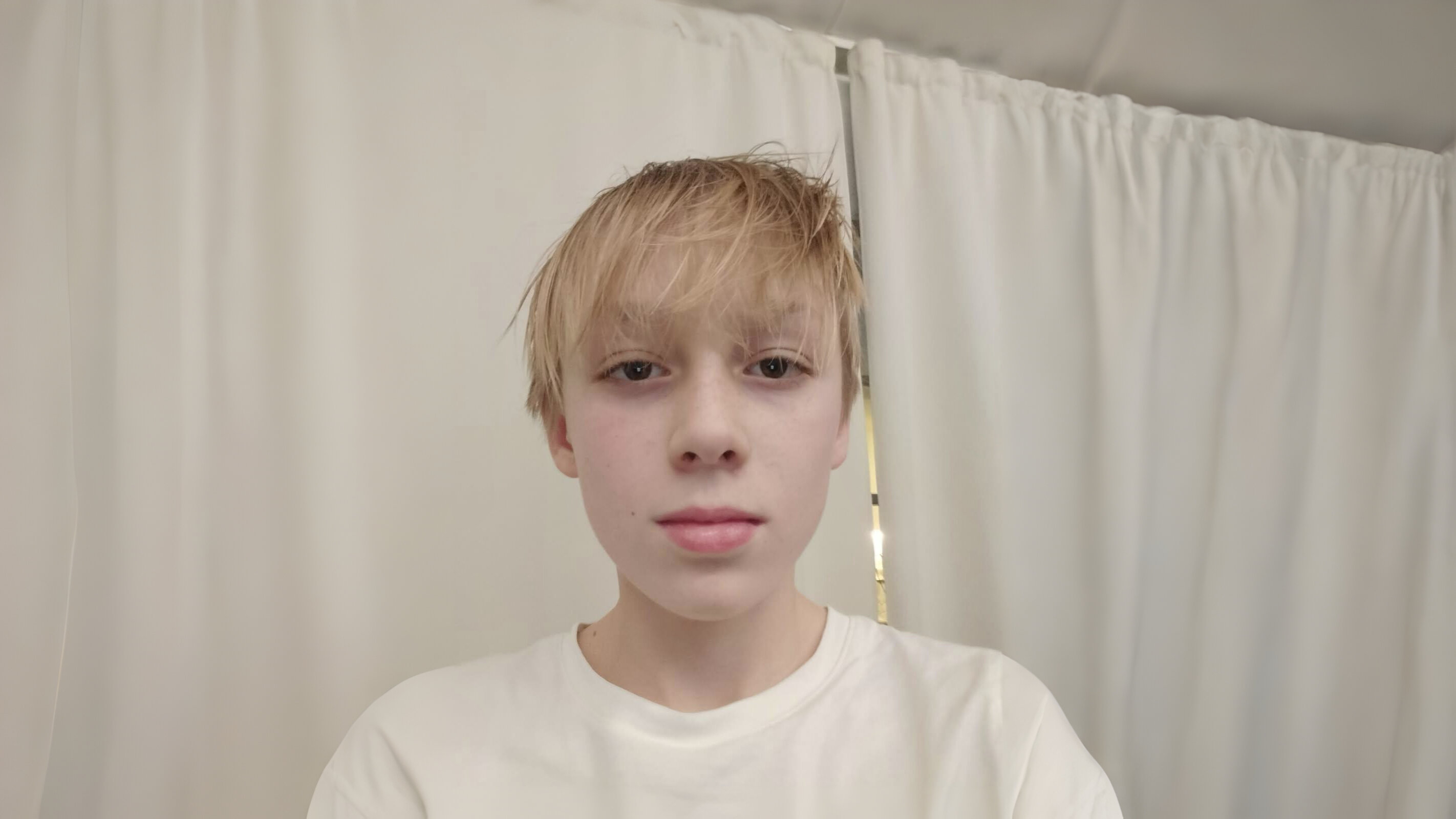 Anton SA Skin